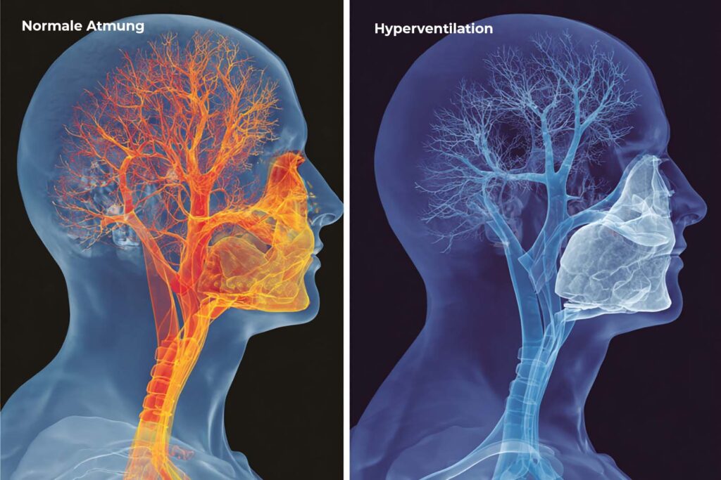 Zweiteiliges Gehirndiagramm vergleicht Gehirndurchblutung: Links 'Normale Atmung' (optimale Sauerstoffabgabe), Rechts 'Hyperventilation' (verengte Gefäße und gestörte Sauerstoffabgabe durch Bohr-Effekt bei CO2-Mangel).